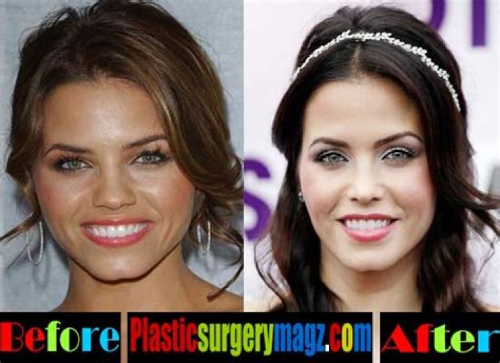 Jenna Dewan Plastic Surgery Before and After