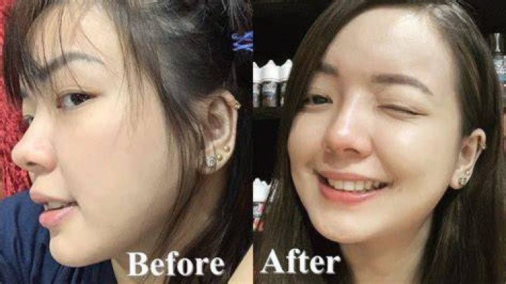 Rosmar Tan Plastic Surgery