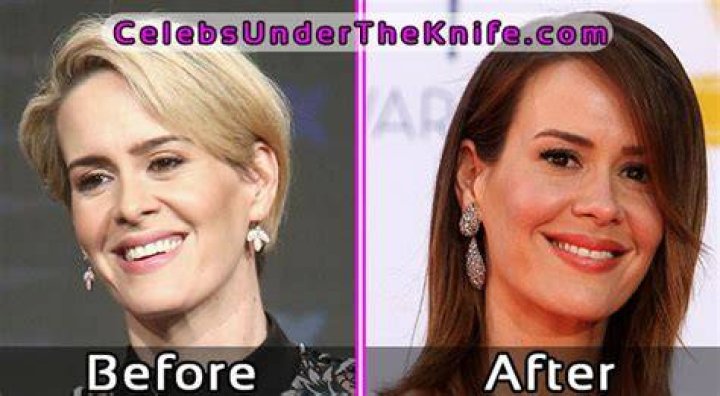 Sarah Paulson Plastic Surgery Before and After